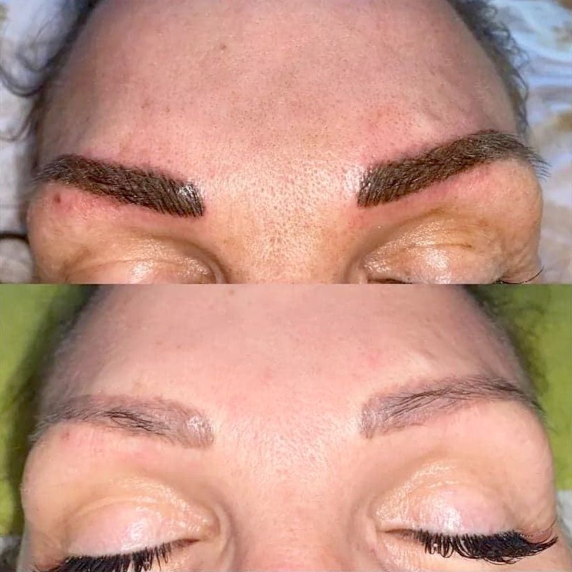 Microblading